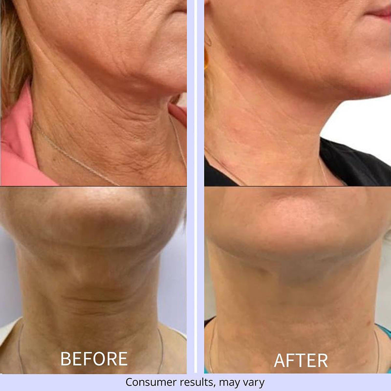 Facial Neck Chest Tightening Cream